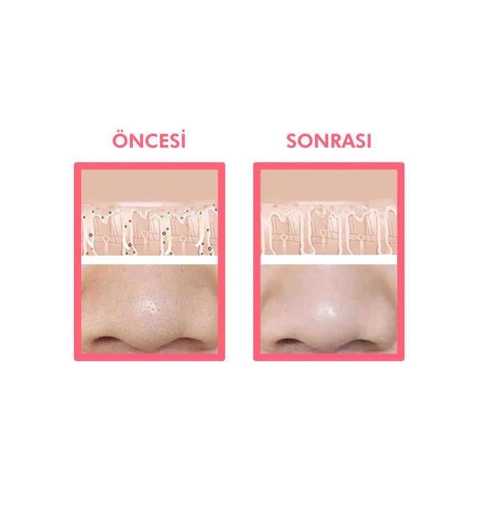 (KIRILABİLİR) 2'li Set Ampul 7'li Serum Portakal İçerikli + Cilt Temizleme Fırçası Klasik