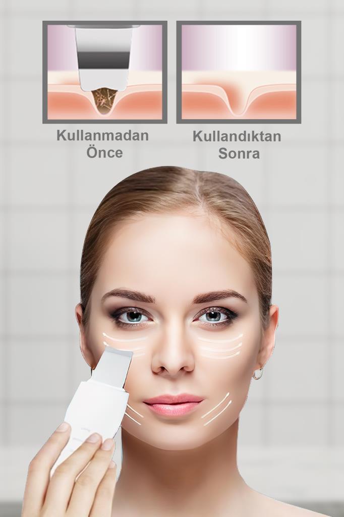 Kalın Gövde Ultrasonic Spatula