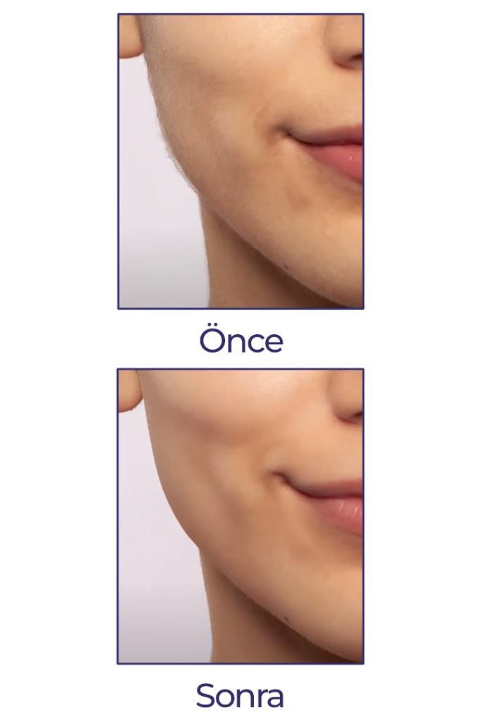 Flawless Yüz Tüy Alıcı Kaş Bıyık Kıl Epilasyon Aleti