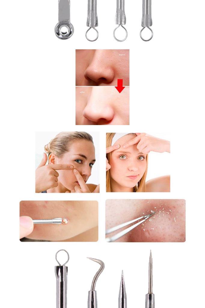 4'lü Siyah Nokta Temizleyici Komedon