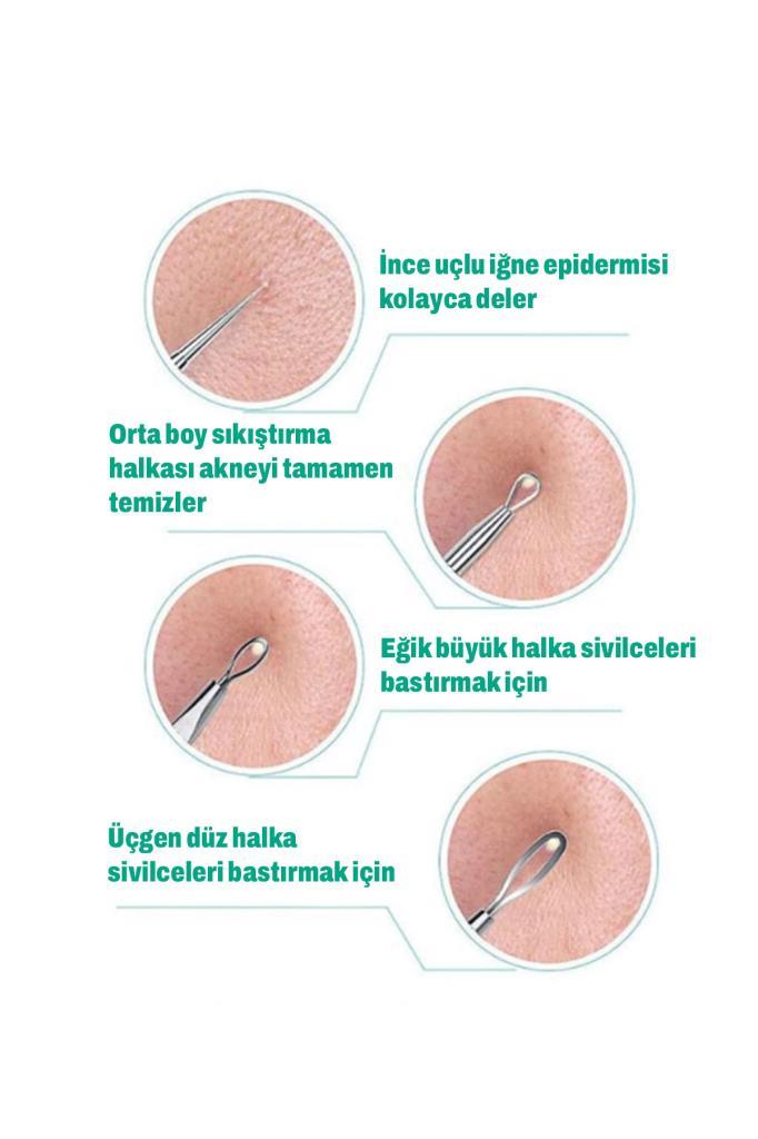Paslanmaz Çelik Siyah Nokta Temizleyici 5'li Komedon Seti